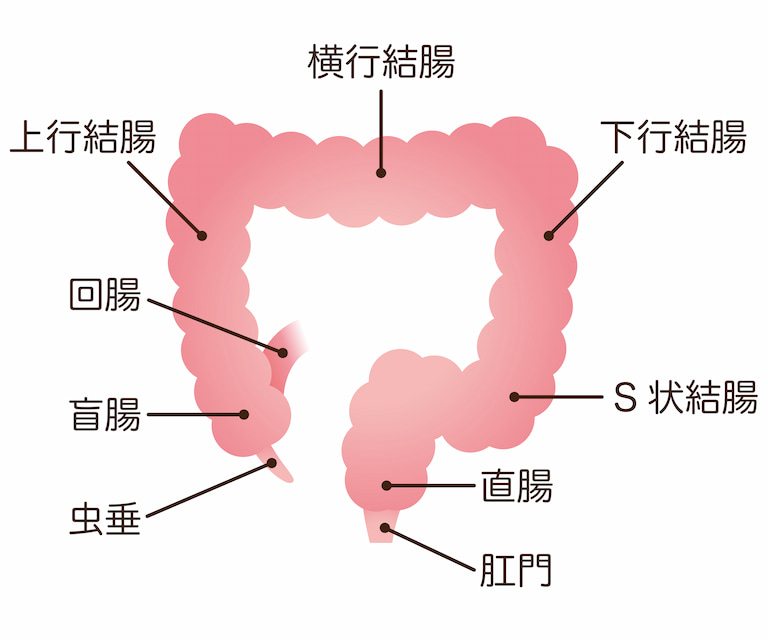 病名として使われる「宿便」は、S状結腸や直腸などに長期間存在して硬くなった便塊のことを指します