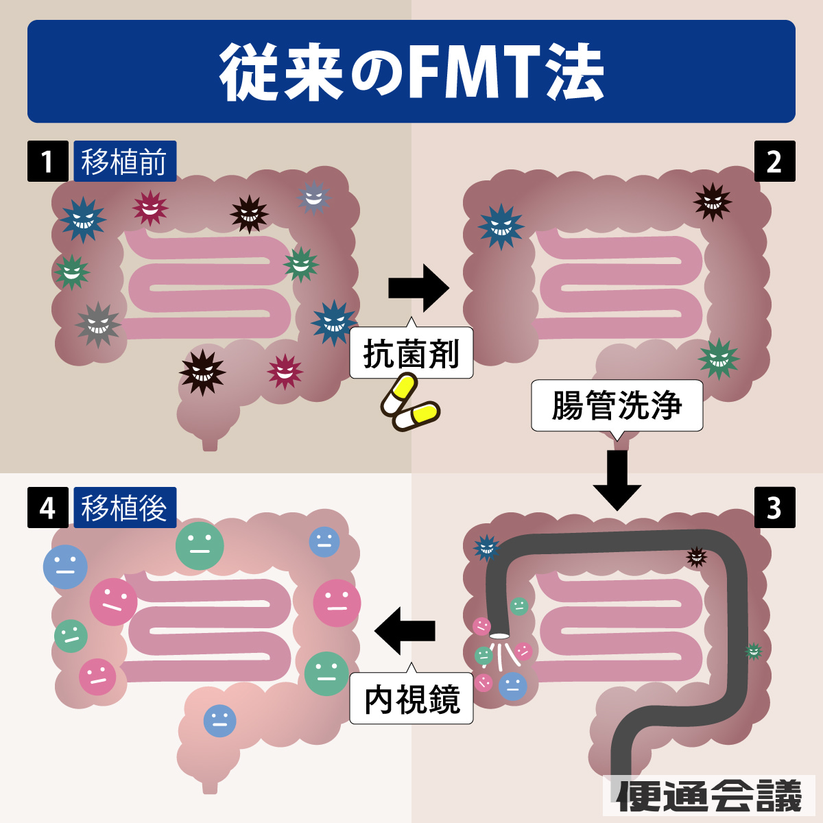 従来のFMT法