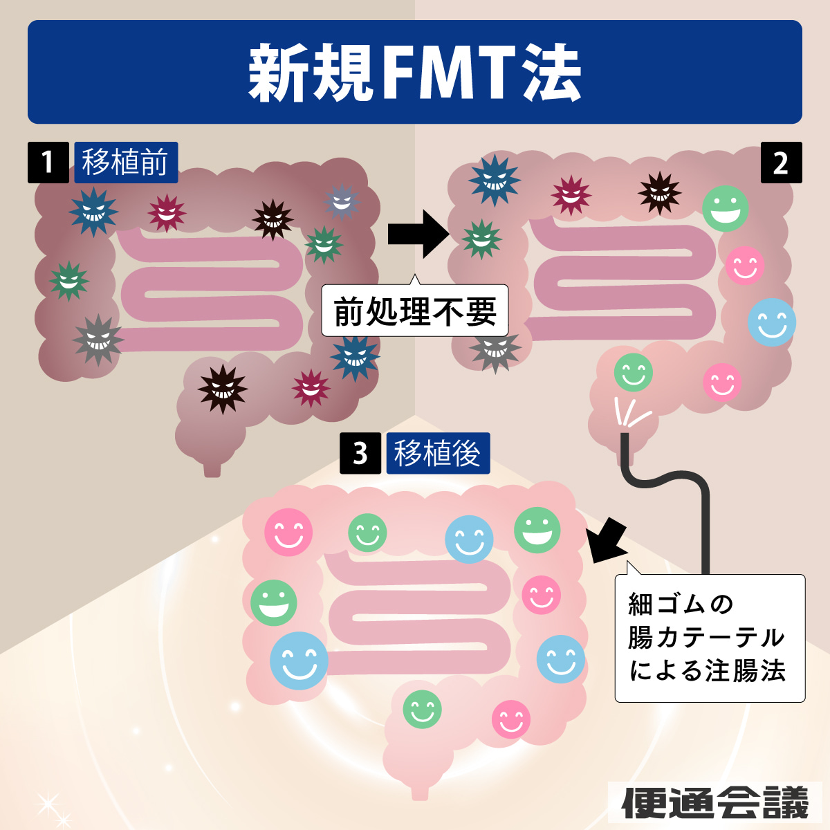 新規FMT法