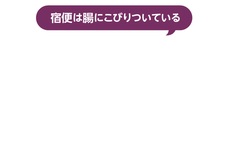 宿便は腸にこびりついている