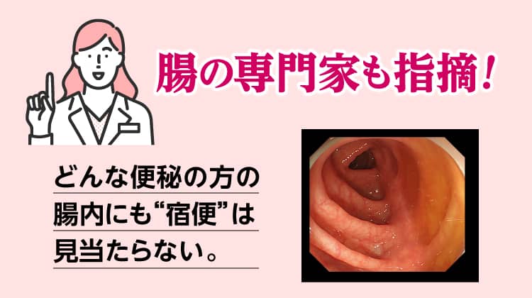 腸の専門家も指摘　どんな便秘の方の腸内にも宿便は見当たらない