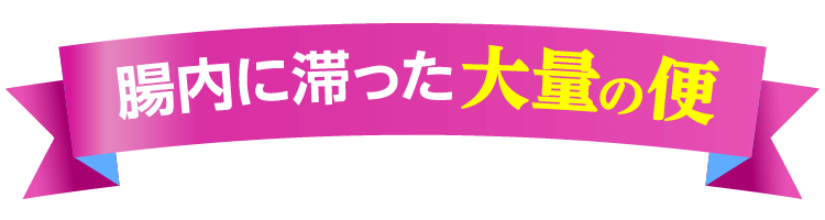 腸内に滞った大量の便